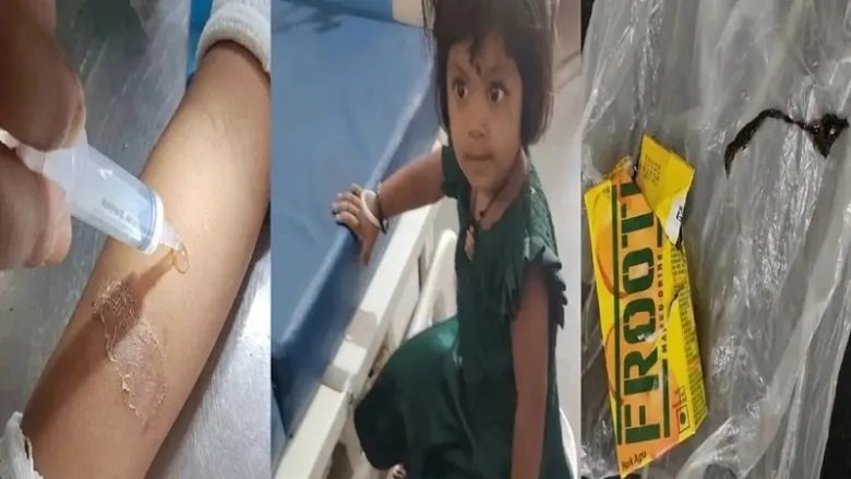 CG News : 10 रुपए की फ्रूटी में निकली छिपकली, पीते ही मासूम बच्ची की तबीयत बिगड़ी, इलाके में हड़कंप Untitled 243