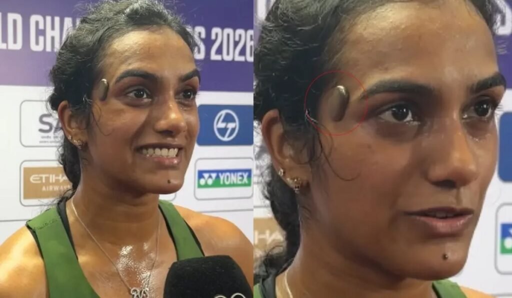 PV Sindhu के माथे पर दिखा खास डिवाइस, Zomato को-फाउंडर से है इसका गहरा कनेक्शन; जानें कैसे करता है काम Untitled 210