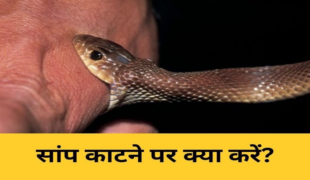Snake Bite: सांप काट ले तो घबराएं नहीं, तुरंत करें ये काम; पहला घंटा बचा सकता है मरीज की जान Untitled 279